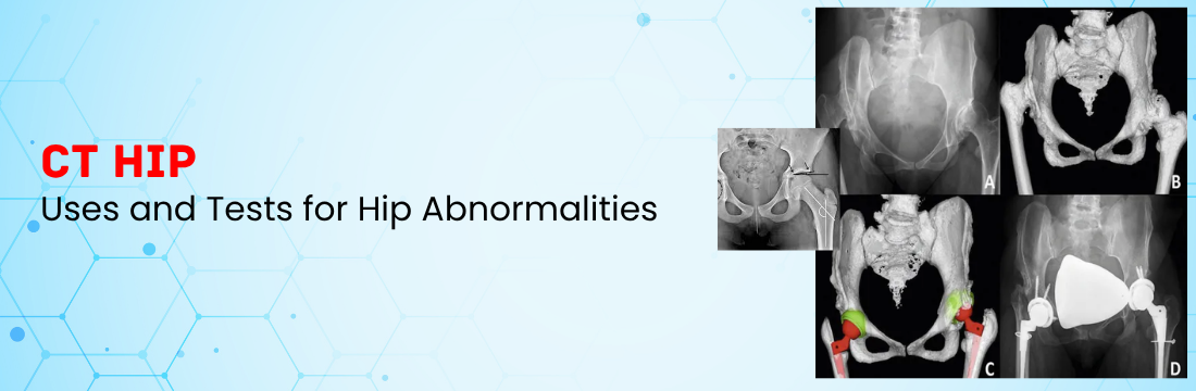 CT Hip: What are the Uses?